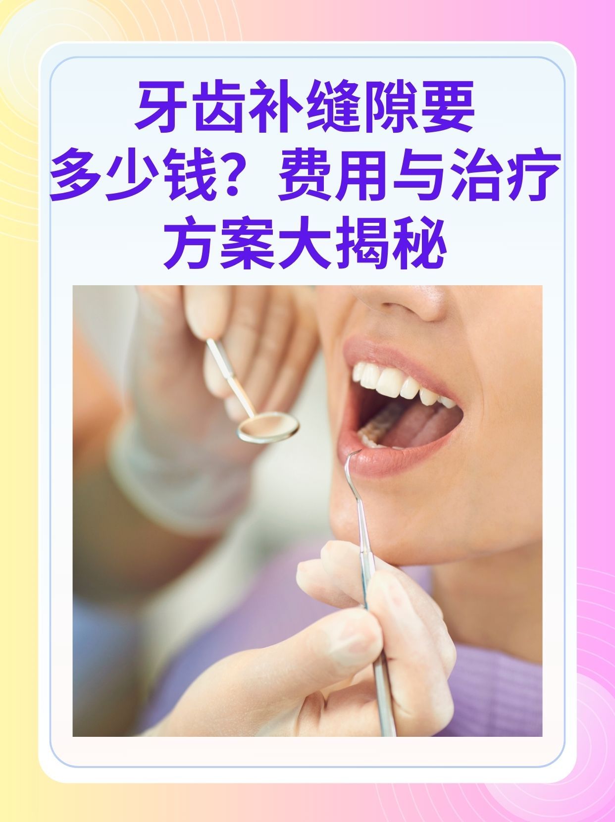 安顺补牙医保可以报销吗(补牙医保可以报销吗 哪些可以报销呢)